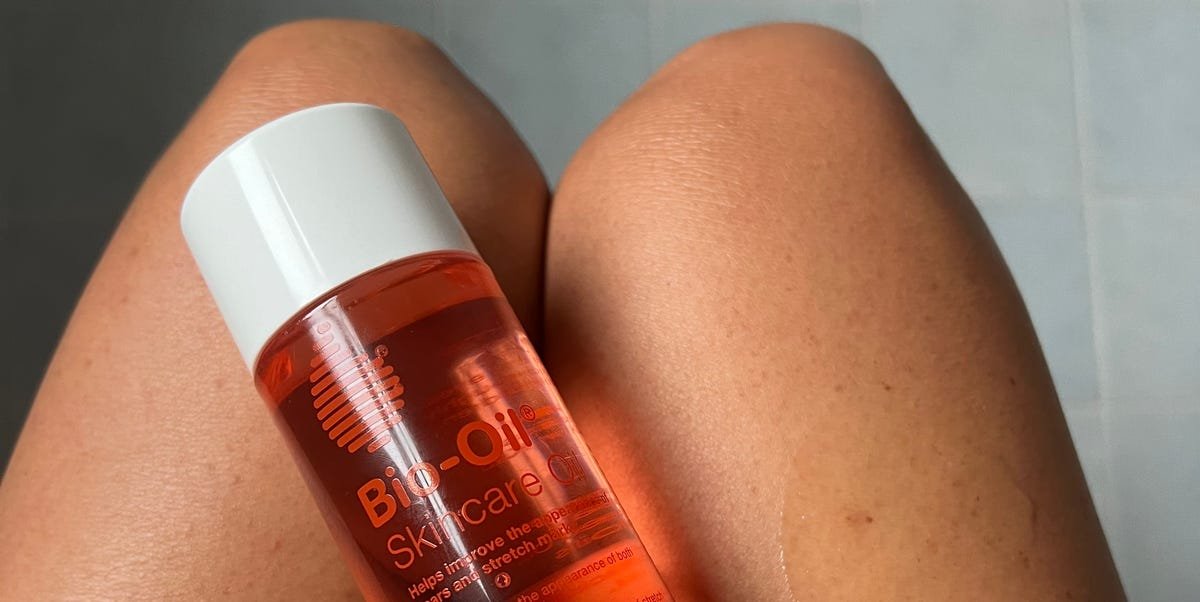 Top 6 Dermatologist-Approved Stretch Mark Creams You Should Consider