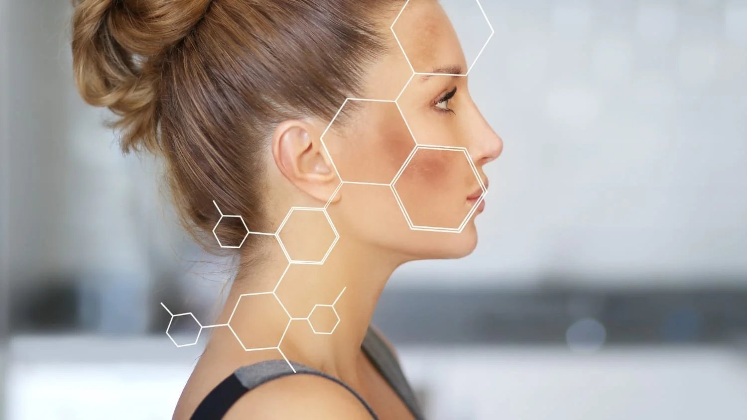 Ultimate Guide to Hyperpigmentation: Causes, Effective Treatments, and Prevention Strategies for Flawless Skin