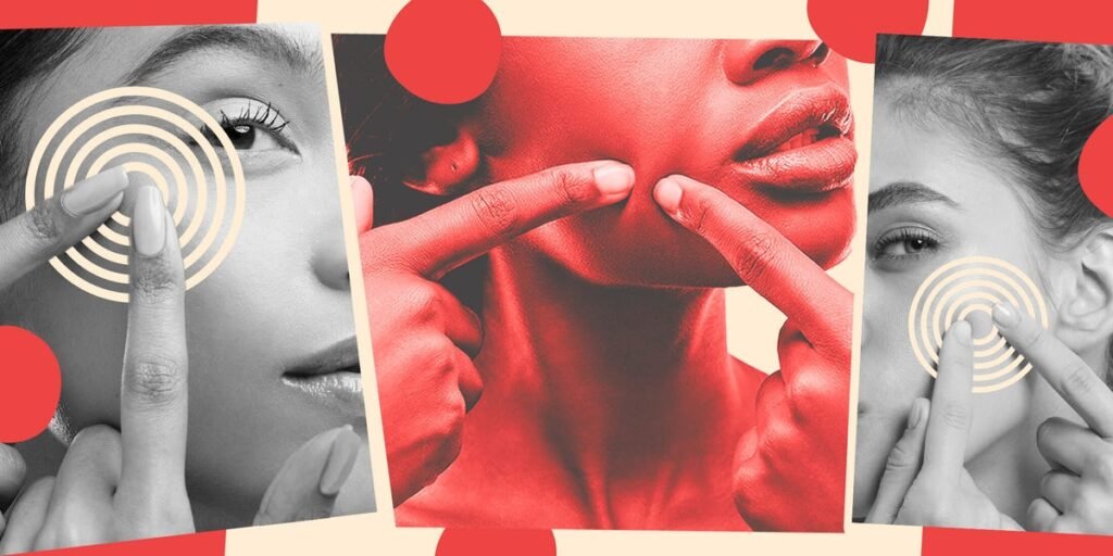 18 Common Skin Bumps You Should Never Pop: Understanding Their Normality