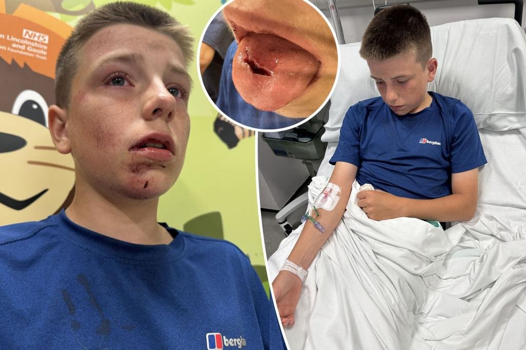 Teen Faces Serious Injury in Disturbing Social Media ‘Tap Out’ Challenge – A Cautionary Tale